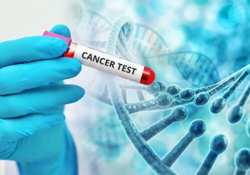 Cercetătorii au dezvoltat un test care poate detecta cancerul într-o singură oră