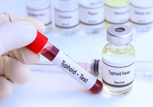 CAZ DE FEBRĂ TIFOIDĂ CONFIRMAT ÎN REPUBLICA MOLDOVA